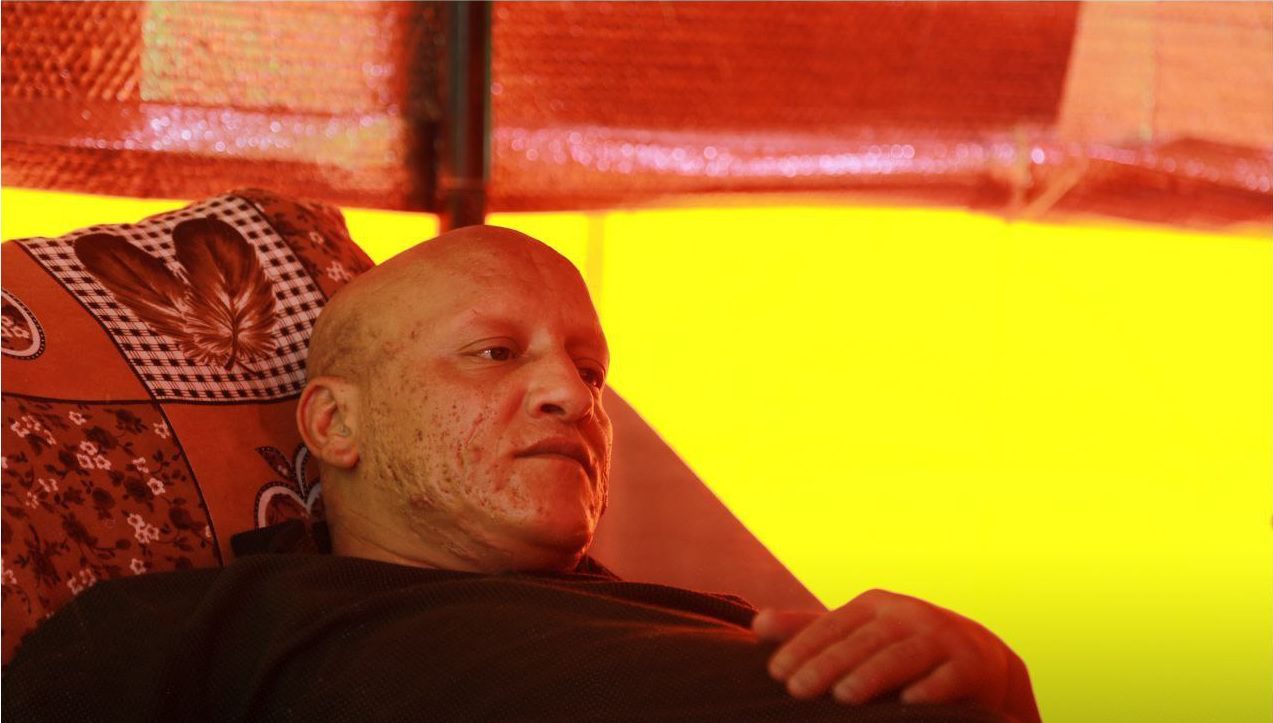 Cancer Patients Besieged in Northwestern Syria: A Humanitarian Crisis Unfolds