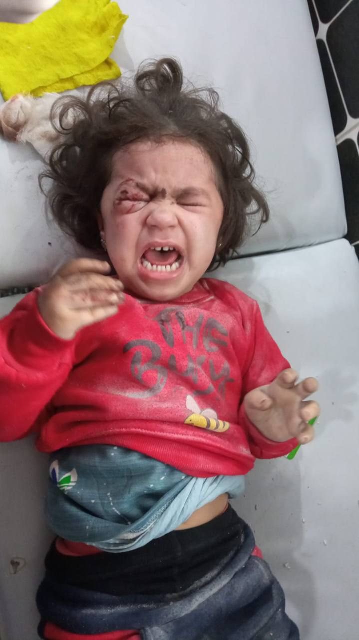Ongoing Assad Regime Attacks in Northern Syria Terrorize Civilians and Injure Children