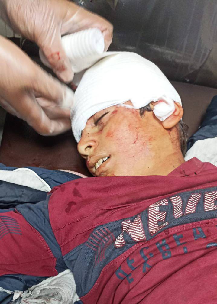 Assad Regime and Russian-Backed Forces Attack School in the Village of Afes
